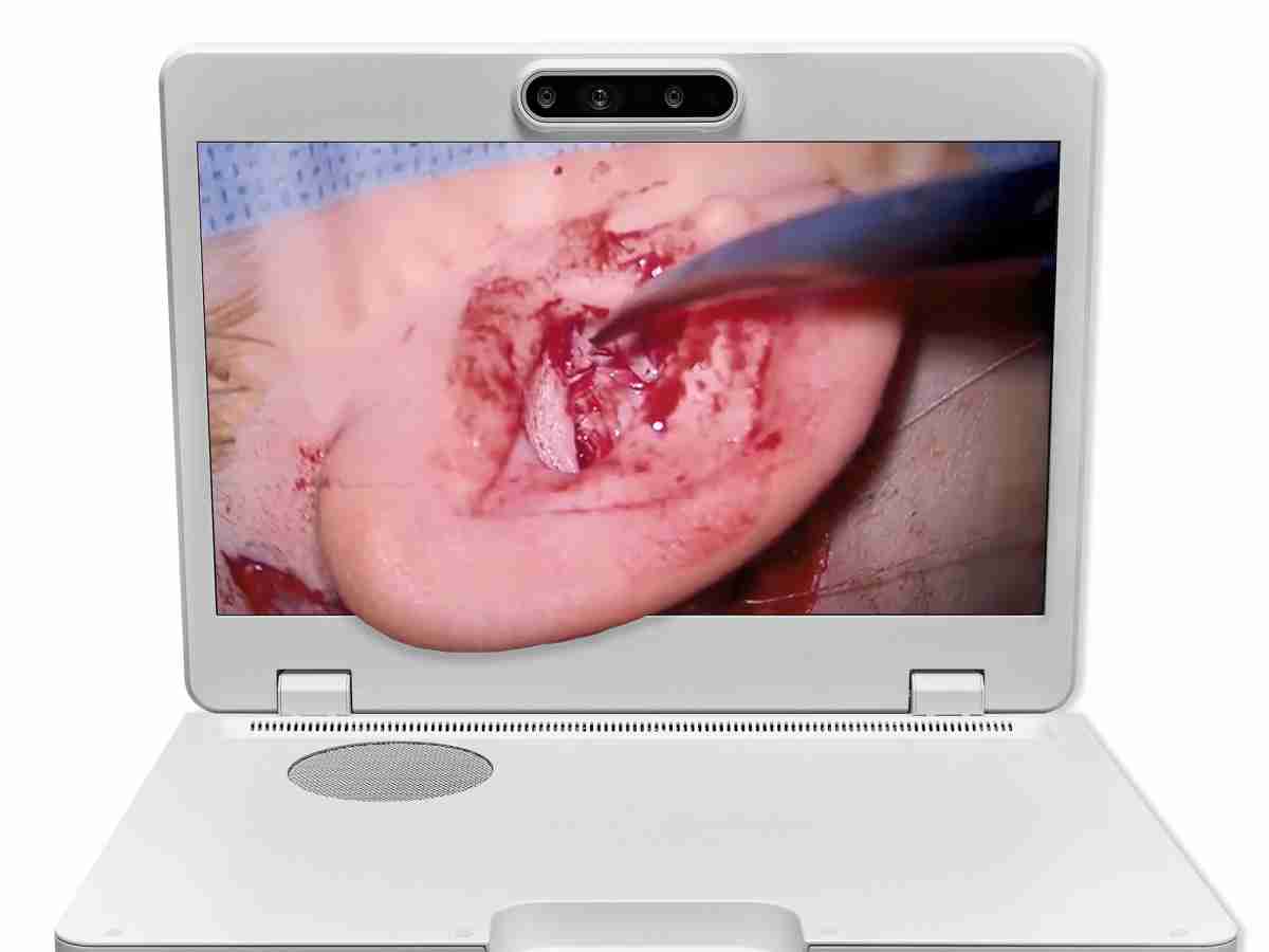 达擎之＂Heads-up 3D显微手术显示系统＂，，，，整合4K裸眼3D显示及眼球追踪系统，，具备快速追踪人眼移动位置功能，，，，减轻医师长时间维持固定姿势的负担，，让医师能有更宽广清晰的3D立体视野及更舒适的姿势来执行手术。。。。